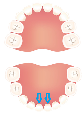 ,歯医者,0歳,歯の生え方