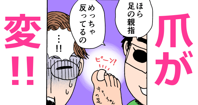 子どもの足の親指の爪が変なことに気付く夫婦,育児,マンガ,息子