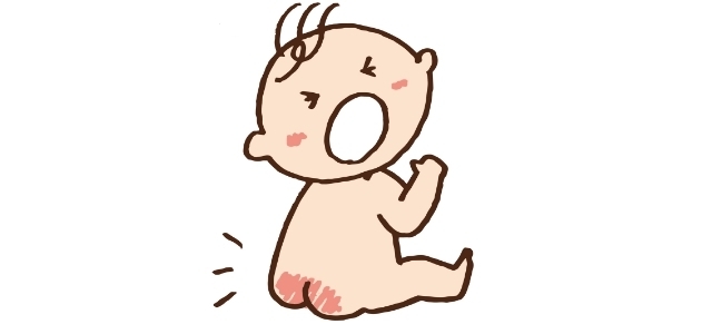 おしりのかぶれた赤ちゃん,おむつ,