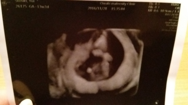 エコー写真 13週2日 13w2d 男の子,妊娠13週,エコー,