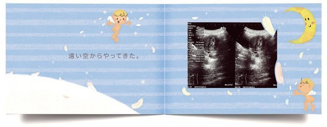 エコー写真アルバム 10ツキ10カものがたり <ひよこ> ,エコー写真,保存,アルバム