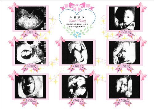 超音波写真アルバム【プリンセス】バリュー「お仕立券」,エコー写真,保存,アルバム