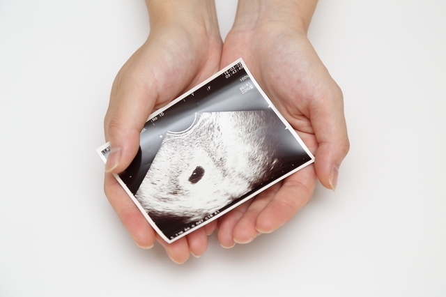 エコー写真,妊娠,3週,症状