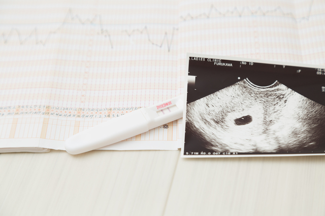 妊娠と基礎体温表,妊娠,高温期,