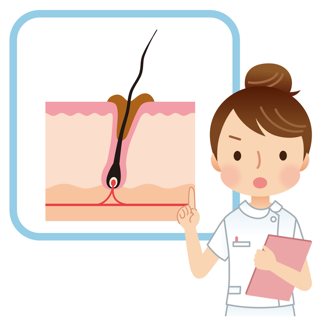 頭皮皮脂,頭,臭い,