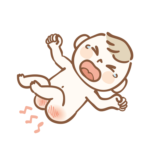 おむつかぶれする,赤ちゃん,おむつ,