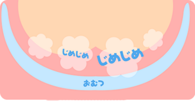 おむつの中は湿気がすごい,