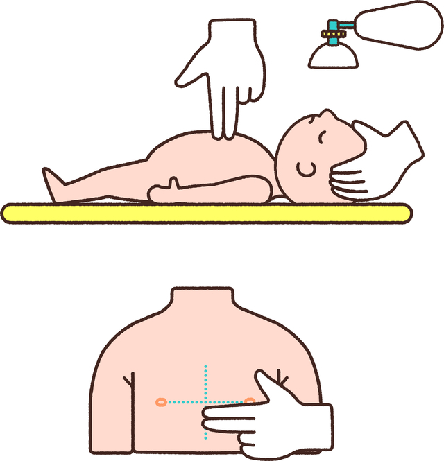 乳児への胸骨圧迫,救急,受診,