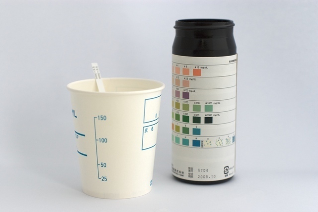 尿検カップと結果,妊娠,尿蛋白,