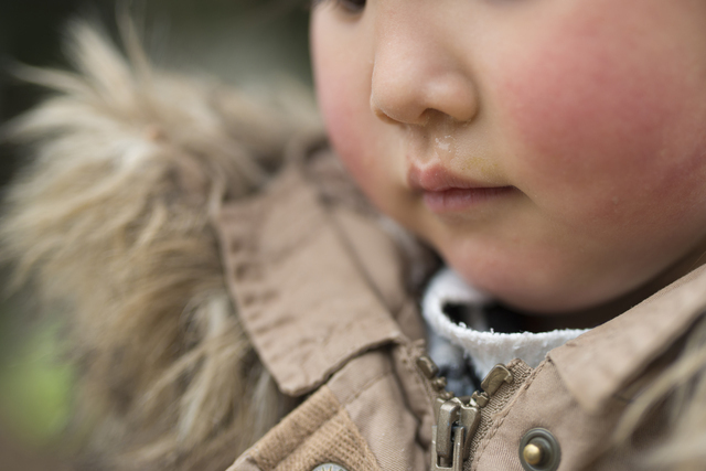 鼻水が出ている子ども,RSウイルス,感染症,