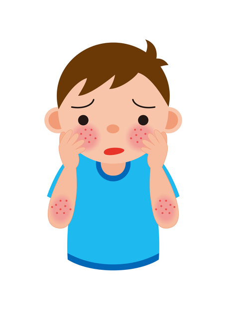 アトピーの男の子イメージイラスト,子ども,アトピー,
