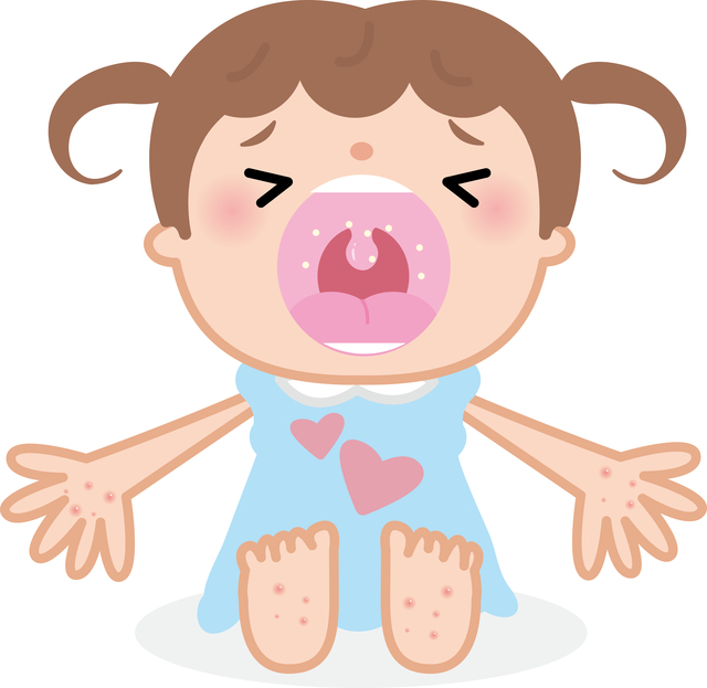 手足口病の女の子,赤ちゃん,手足口病,