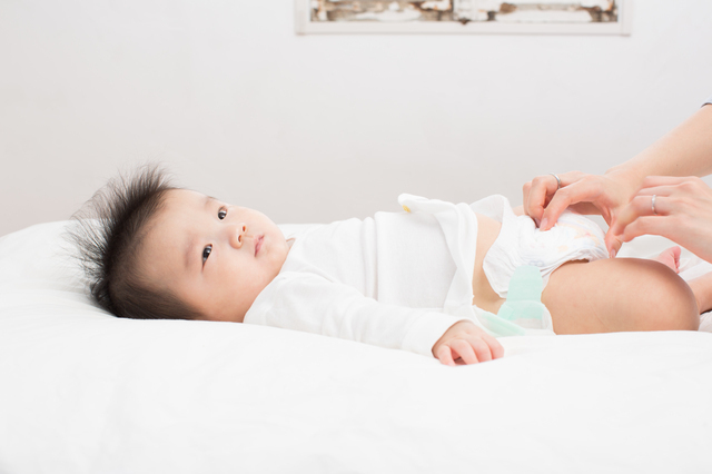 おむつを換える赤ちゃん,赤ちゃん,カンジタ,