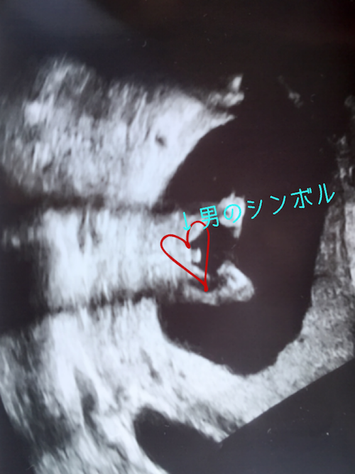 エコー写真 15週2日 15w2d 男の子,妊娠,15週,エコー写真