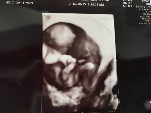 エコー写真 15週2日 15w2d 男の子,妊娠,15週,エコー写真