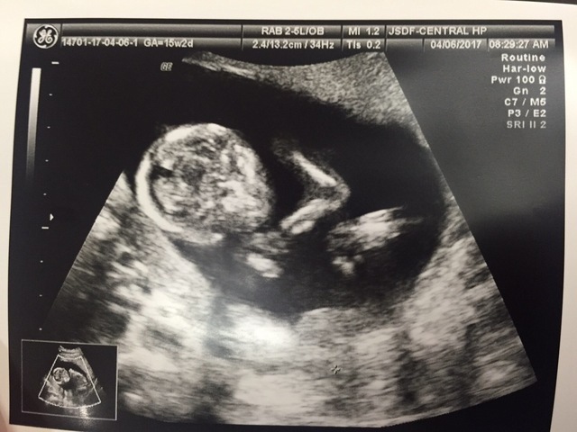 エコー写真 15週2日 15w2d 女の子,妊娠,15週,エコー写真