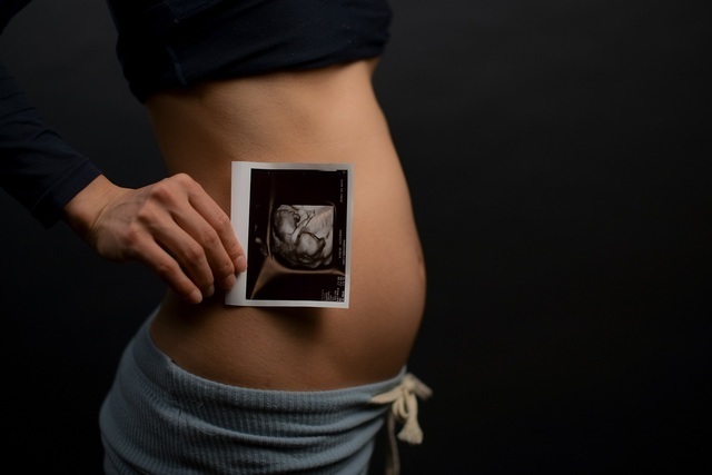 エコ―写真 15週2日 15w2d 男の子 ,妊娠,15週,エコー写真