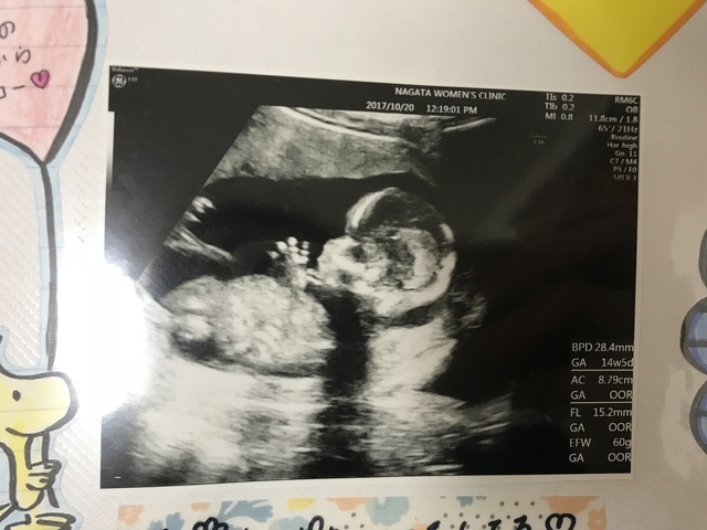 エコ―写真 15週2日 15w2d 男の子 ,妊娠,15週,エコー写真