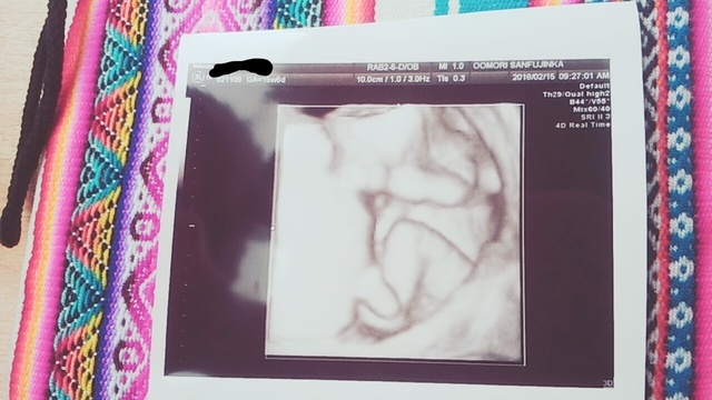 エコ―写真 15週6日 15w6d 男の子 ,妊娠,15週,エコー写真