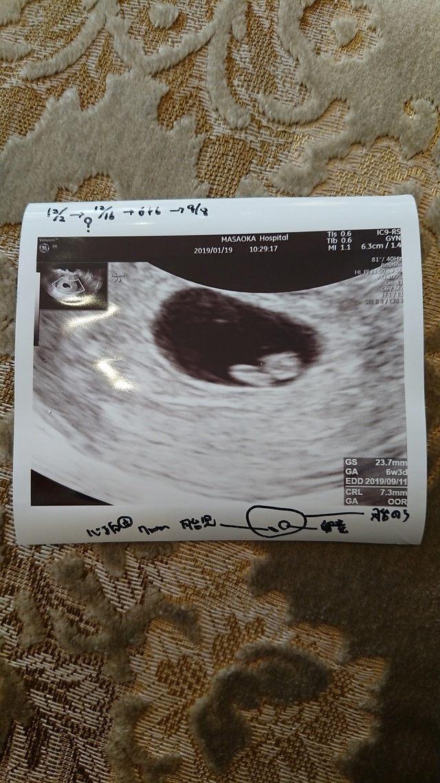 エコー写真 妊娠6週3日 6w3d 不明,エコー写真,妊娠6週,