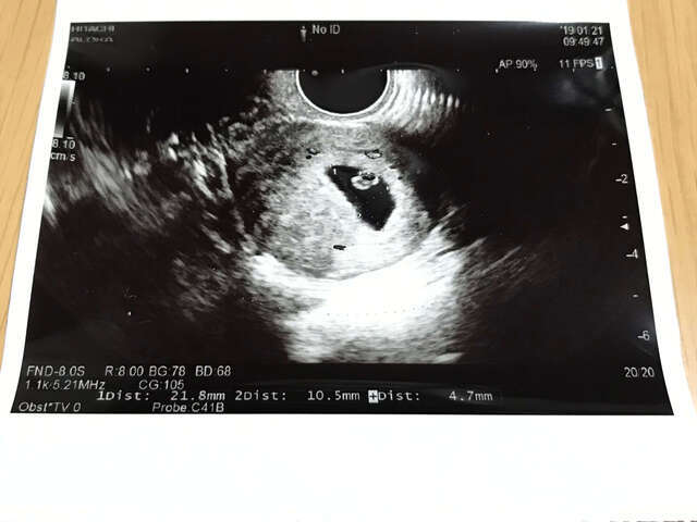 エコー写真 妊娠6週6日 6w6d不明,エコー写真,妊娠6週,