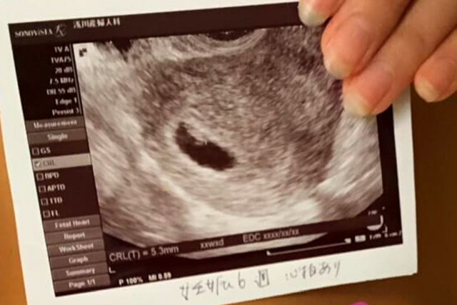 エコー写真 妊娠6週6日 6w6d不明,エコー写真,妊娠6週,
