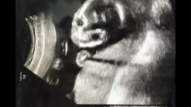 エコー写真 20週0日 20w0d 男の子,妊娠20週,エコー,