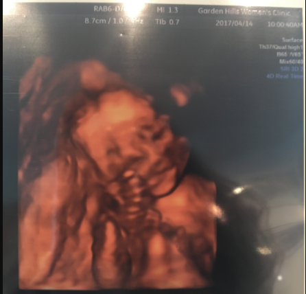 エコー写真 20週0日 20w0d 男の子,妊娠20週,エコー,