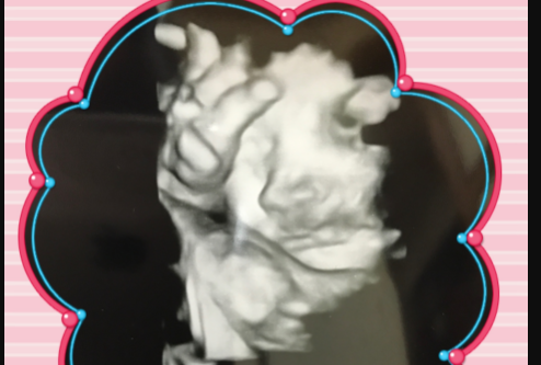 エコー写真 20週0日 20w0d 男の子,妊娠20週,エコー,