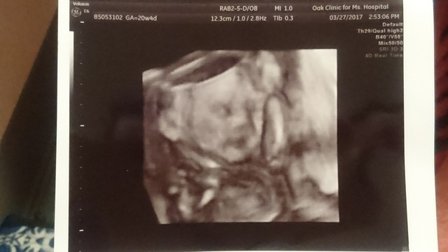 エコー写真 20週0日 20w0d 女の子,妊娠20週,エコー,