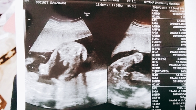 エコー写真 20週0日 20w0d 男の子,妊娠20週,エコー,