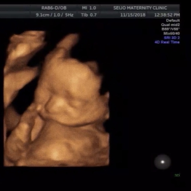 エコー写真 20週0日 20w0d 男の子,妊娠20週,エコー,