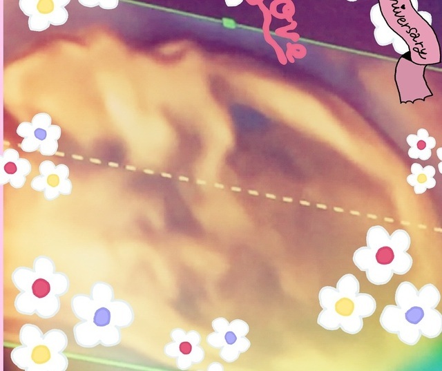 エコー写真 20週2日 20w2d 女の子,妊娠20週,エコー,