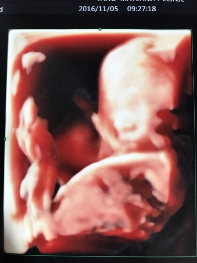 エコー写真 20週5日 20w5d 男の子,妊娠20週,エコー,