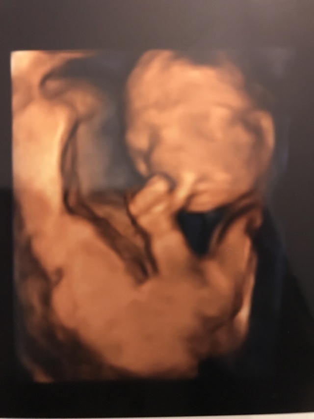 エコー写真 20週5日 20w5d 男の子,妊娠20週,エコー,