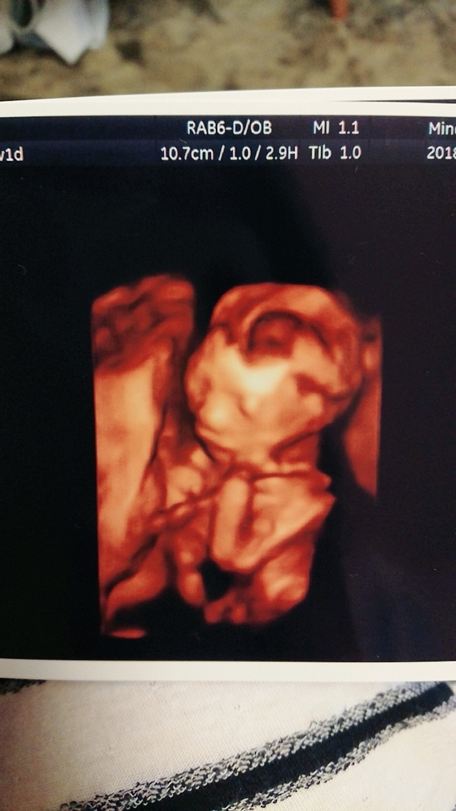 エコー写真 20週5日 20w5d 男の子,妊娠20週,エコー,