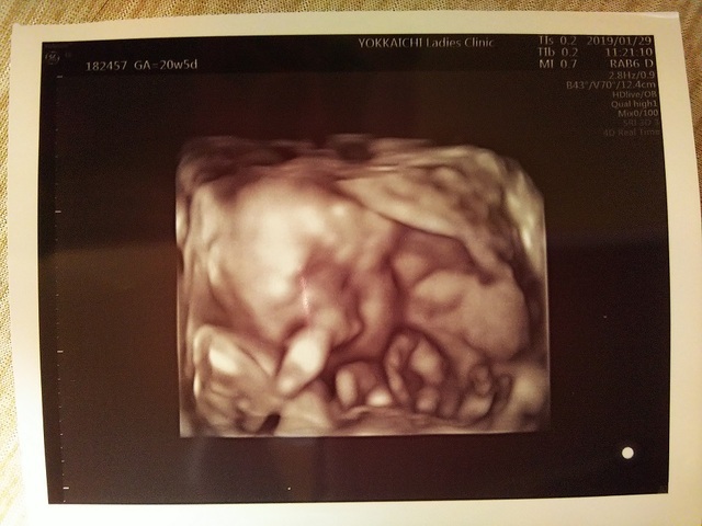 エコー写真 20週5日 20w5d 性別不明,妊娠20週,エコー,