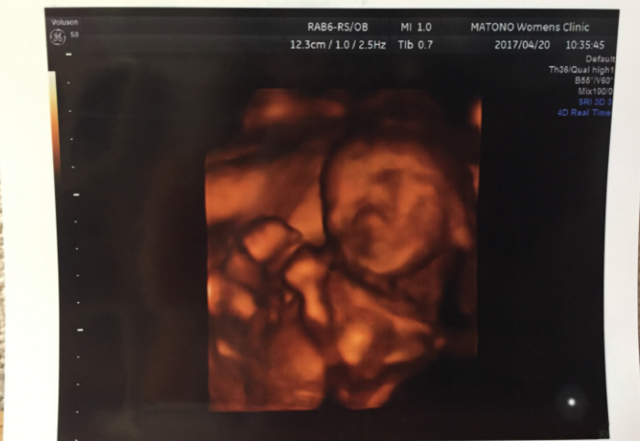 エコー写真 20週6日 20w6d 男の子,妊娠20週,エコー,