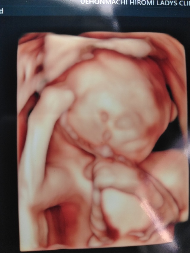 エコー写真 20週6日 20w6d 女の子,妊娠20週,エコー,