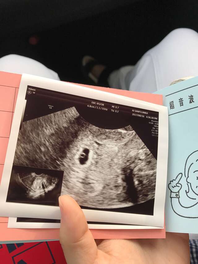 ,妊娠4週,エコー,