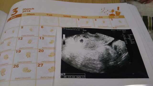 ,妊娠4週,エコー,
