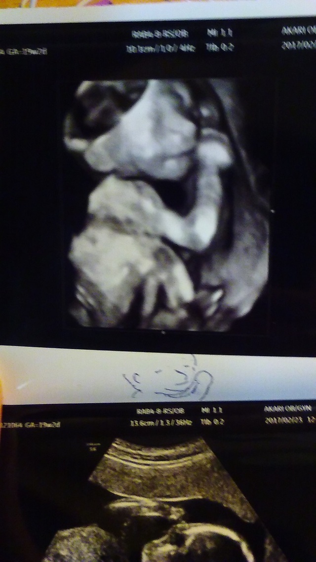 エコー写真 19週2日 19w2d 女の子,妊娠19週,エコー,