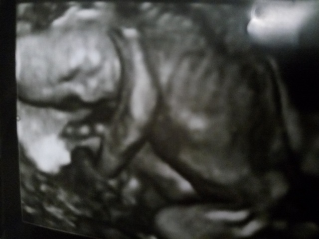 エコー写真 19週3日 19w3d 女の子,妊娠19週,エコー,