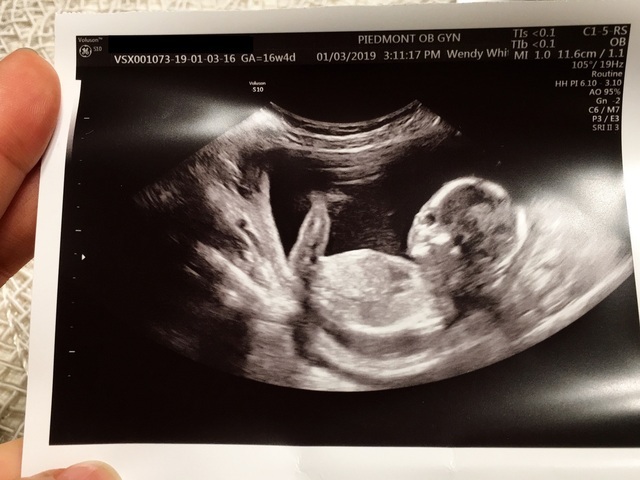 エコー写真 19週3日 19w3d 男の子,妊娠19週,エコー,