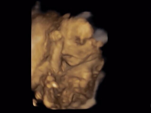 エコー写真 19週0日 19w0d 男の子,妊娠19週,エコー,