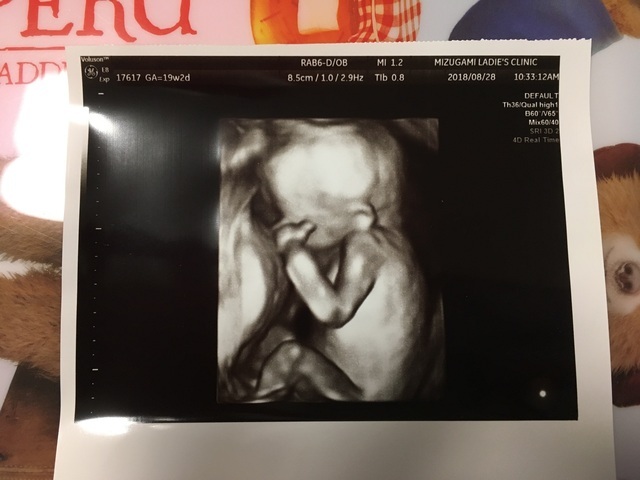 エコー写真 19週2日 19w2d 女の子,妊娠19週,エコー,