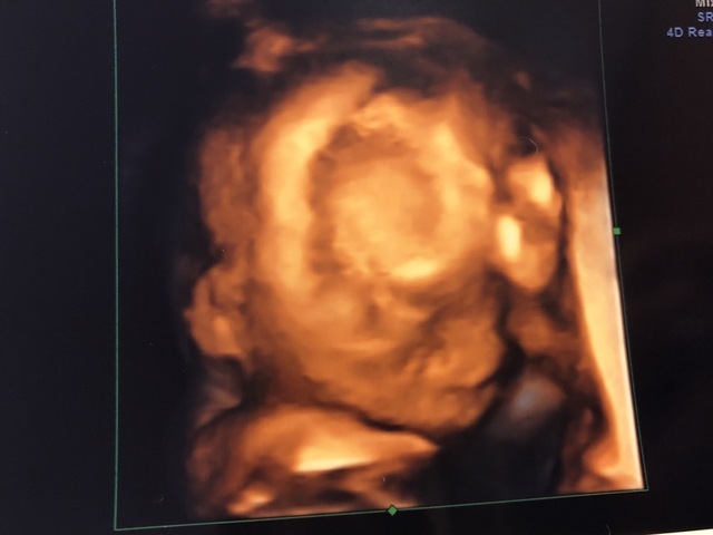 エコー写真 19週2日 19w2d 男の子,妊娠19週,エコー,