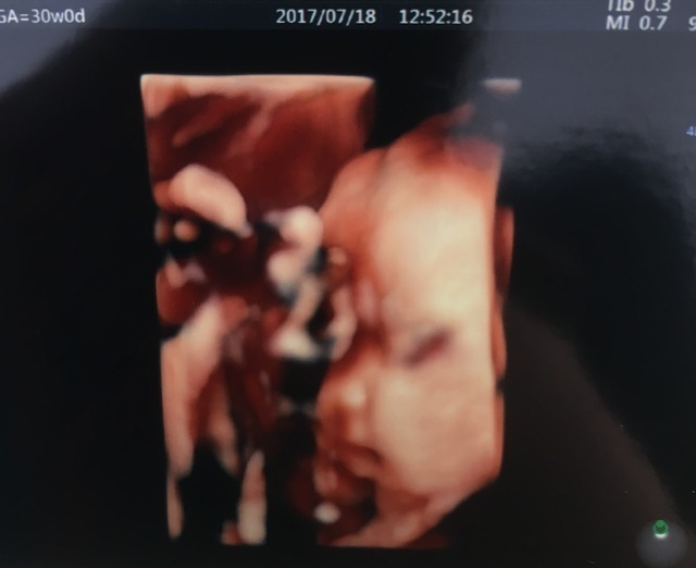 エコー写真 30週0日 30w0d 女の子,妊娠,30週,エコー写真