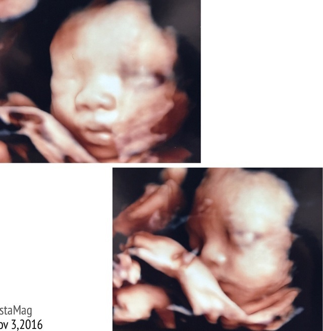 エコー写真 30週0日 30w0d 女の子,妊娠,30週,エコー写真