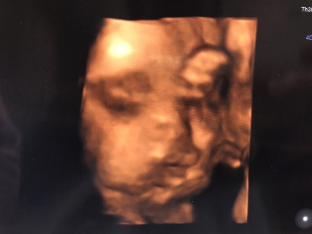 エコー写真 30週0日 30w0d 女の子,妊娠,30週,エコー写真